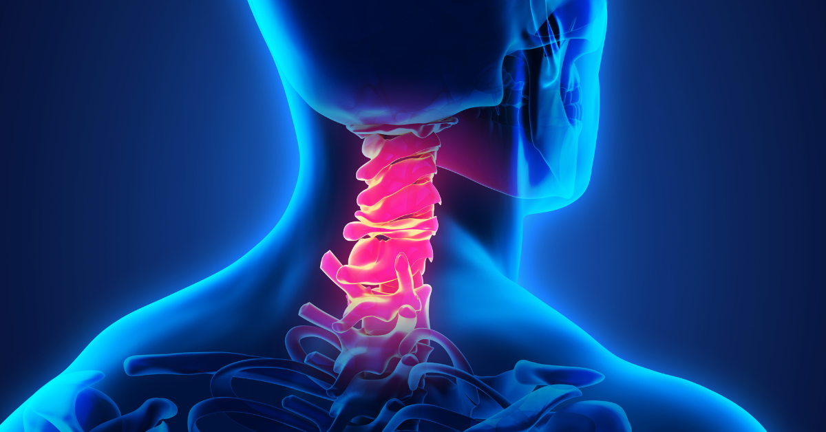 Understanding Car Accident Neck Injuries: From Whiplash to Cervical Fractures | Attorney Blog - Kendall Law Group LLC